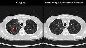 Creation of the CT Scan