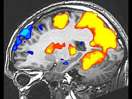fMRI