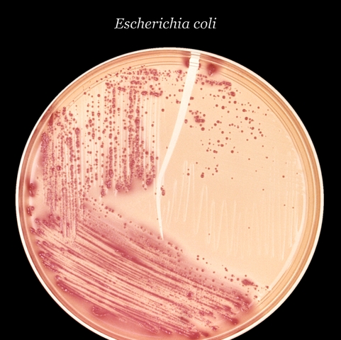 Madel and Higa ere responsible for the first transformation of the bacterium Escerichia coli.