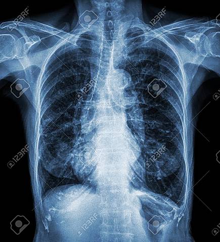 INSTITUCIONES PARA EL CUIDADO