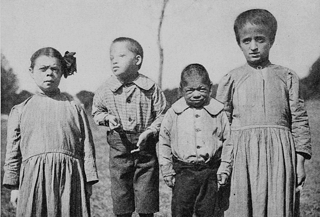 Watson v. City of Cambridge