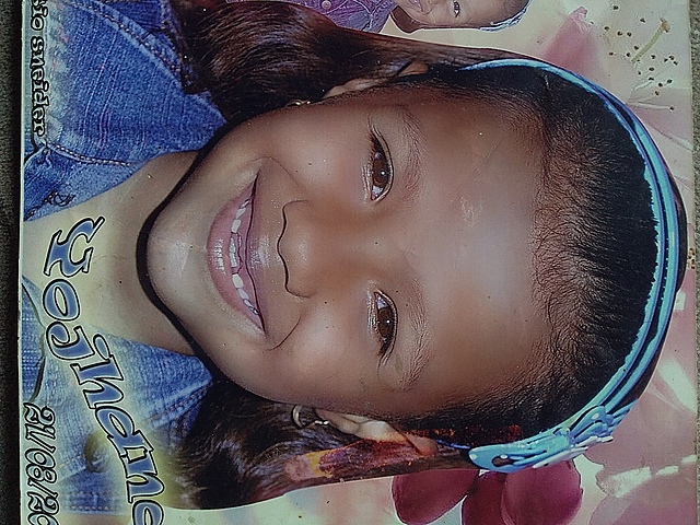 I when my teeth fell