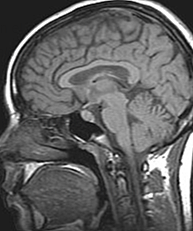 el campo de la resonancia magnética nuclear
