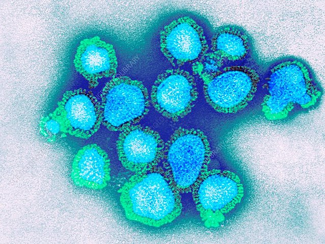 NUEVO VIRUS DE INFLUENZA