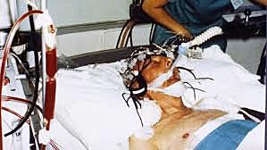 Enfermedad, agonía y muerte de Franco.