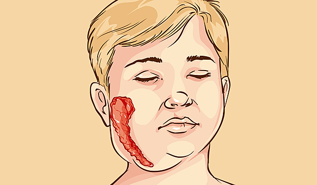 VACUNA ANTIPARODÍTICA