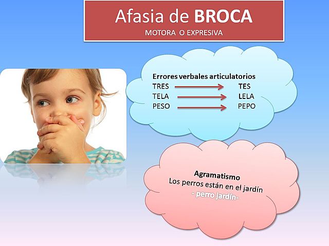PIERRE PAUL BROCA