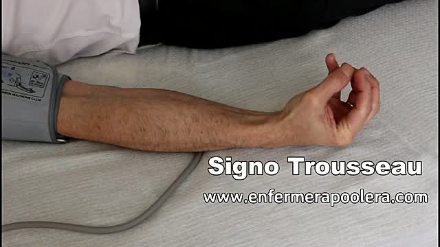 Trousseau describe el signo que lleva su nombre.