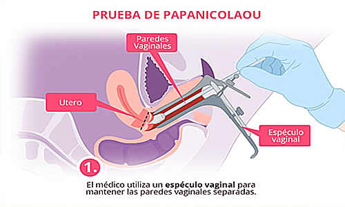 Papanicolaou introduce el estudio de frotis vaginal