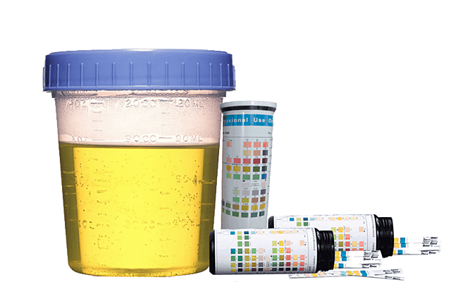 Dobson; identificó la presencia de glucosa en la orina.