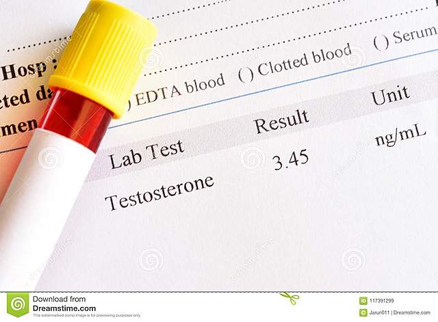 Lazerda estudia la variación circadiana de la testosterona en plasma en hombres sanos