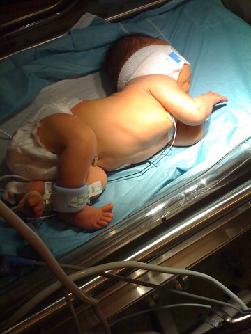 Back to the Hospital