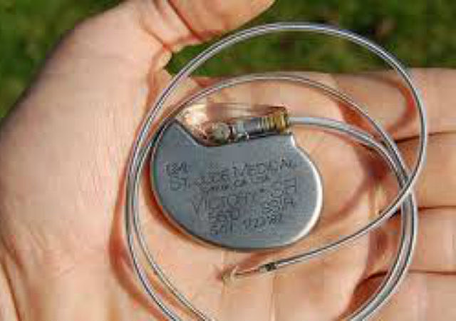 Creación del marcapasos