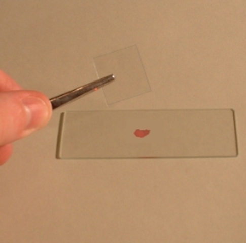 Ability to look at genes on slide was developed