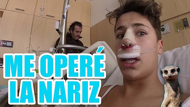OPERACION DE NARIZ