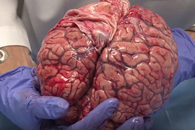 Reconocimiento del Cerebro