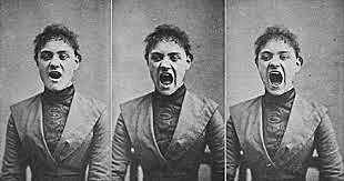 Psiquiatría Barroca