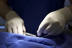 La eugenesia en la sociedad