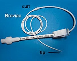Desenvolvimento do cateter de Broviac.