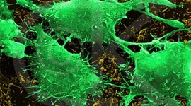 Timeline: Cancer Screenings