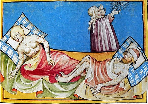 La peste Bubonica