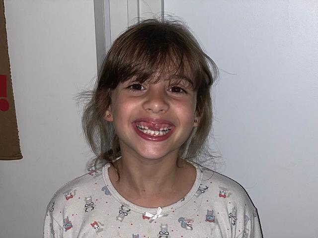 Caída de mi segundo diente