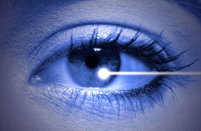 La premier chirurgie oculaire au laser
