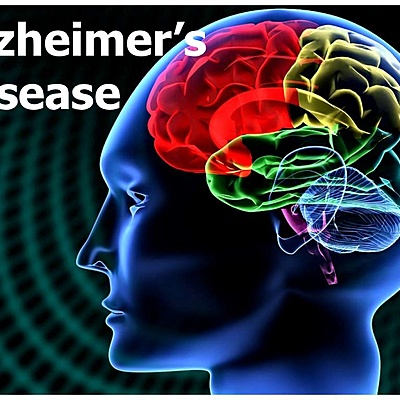 Timeline: Alzheimers Through History