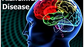 Timeline: Alzheimers Through History