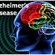 Alzheimers disease management 1 728