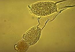 Subreino Eomycota: Quitridiomicetes (división Chytridiomycota)