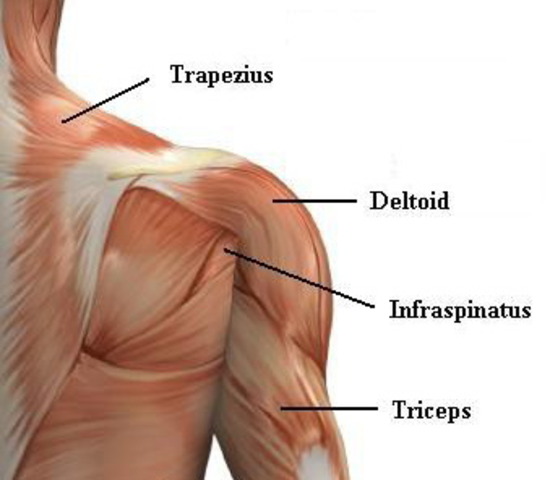 Strain throwing shouler