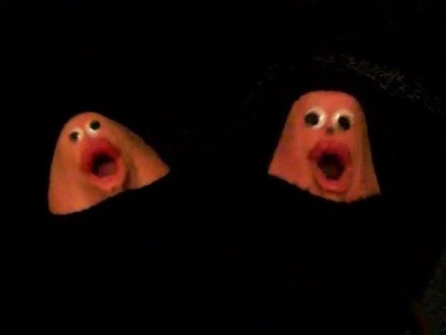 stitches on the chin