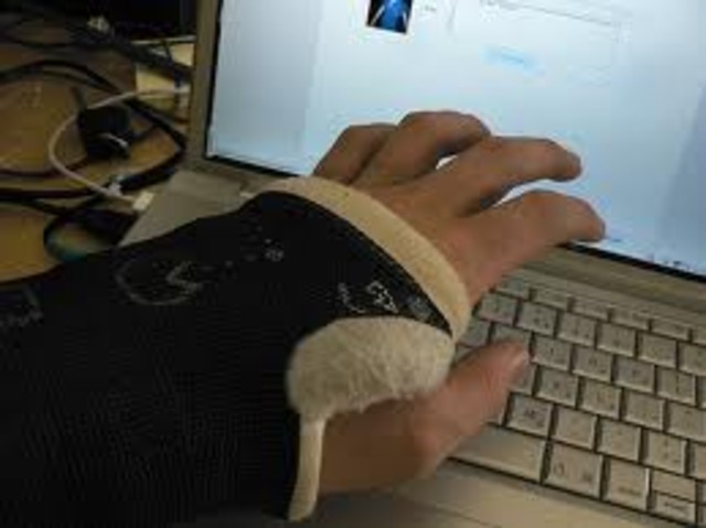 Broken wrist