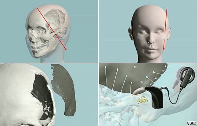 An attack to her life