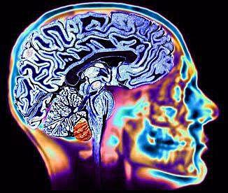 se identifican trastornos geneticos