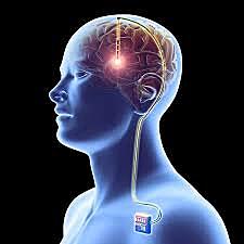 Peluca Con Electrodos