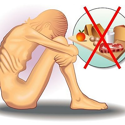 Transición Alimentaria