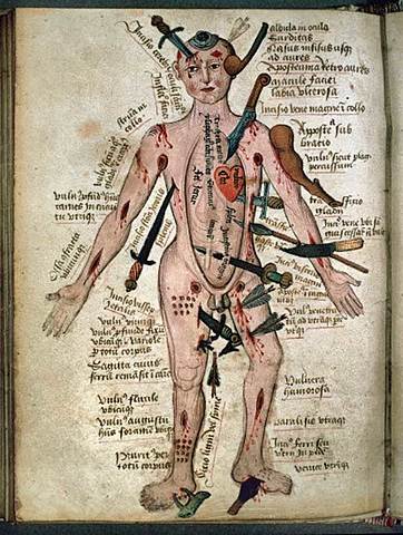 Suceso: Comienzo de las disecciones