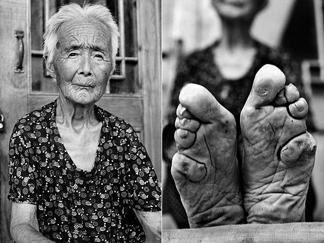Foot binding