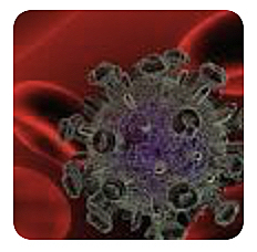 Aparició de la SIDA