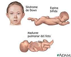 LA PRIMERA ENFERMEDAD GENÉTICA