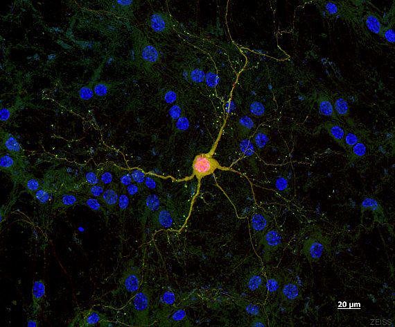 la neurona, estructura básica del sistema nervioso