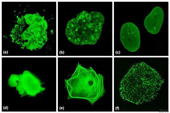 Primer análisis de proteínas en células vivas