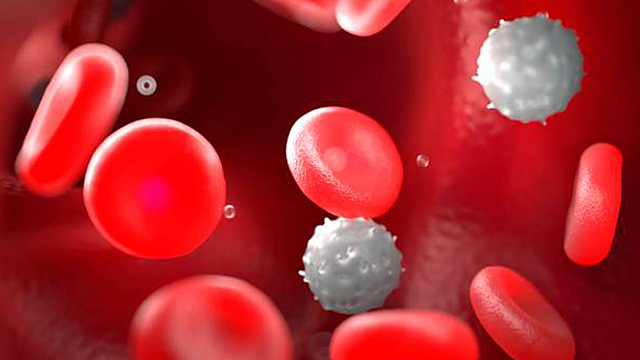 Anna Was Admitted To The Hospital For Extreme Pain Associated With A Sickle Cell Crisis.