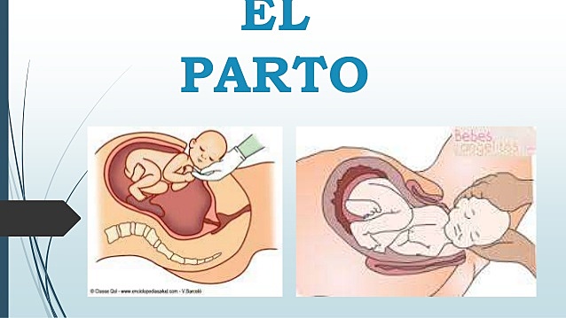 El Parto y sus Etapas (1 etapa)