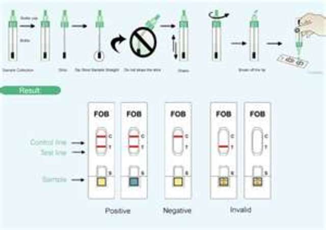 Colorectal Cancer and Polyps - Fecal Occult Blood Test