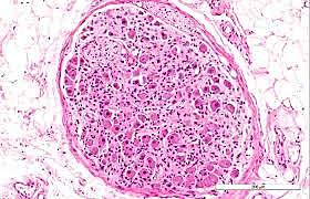 Surgimiento de la cadena ganglionar