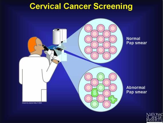 Cervical Cancer - Screening
