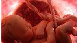 Timeline: DESARROLLO PRENATAL